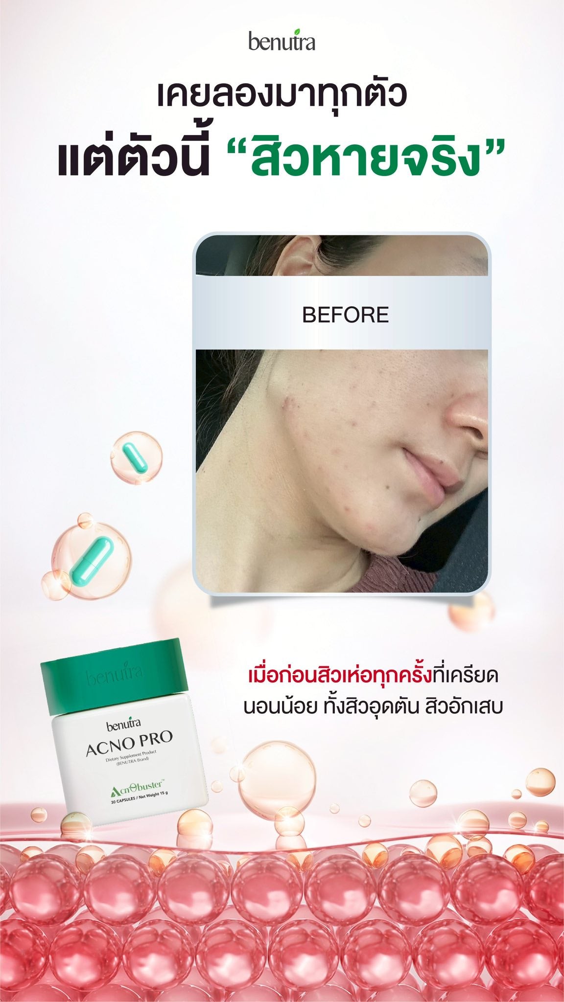 BENUTRA TETRA SOD with Astaxanthin CoQ10 Antioxidant Power for Skin Health