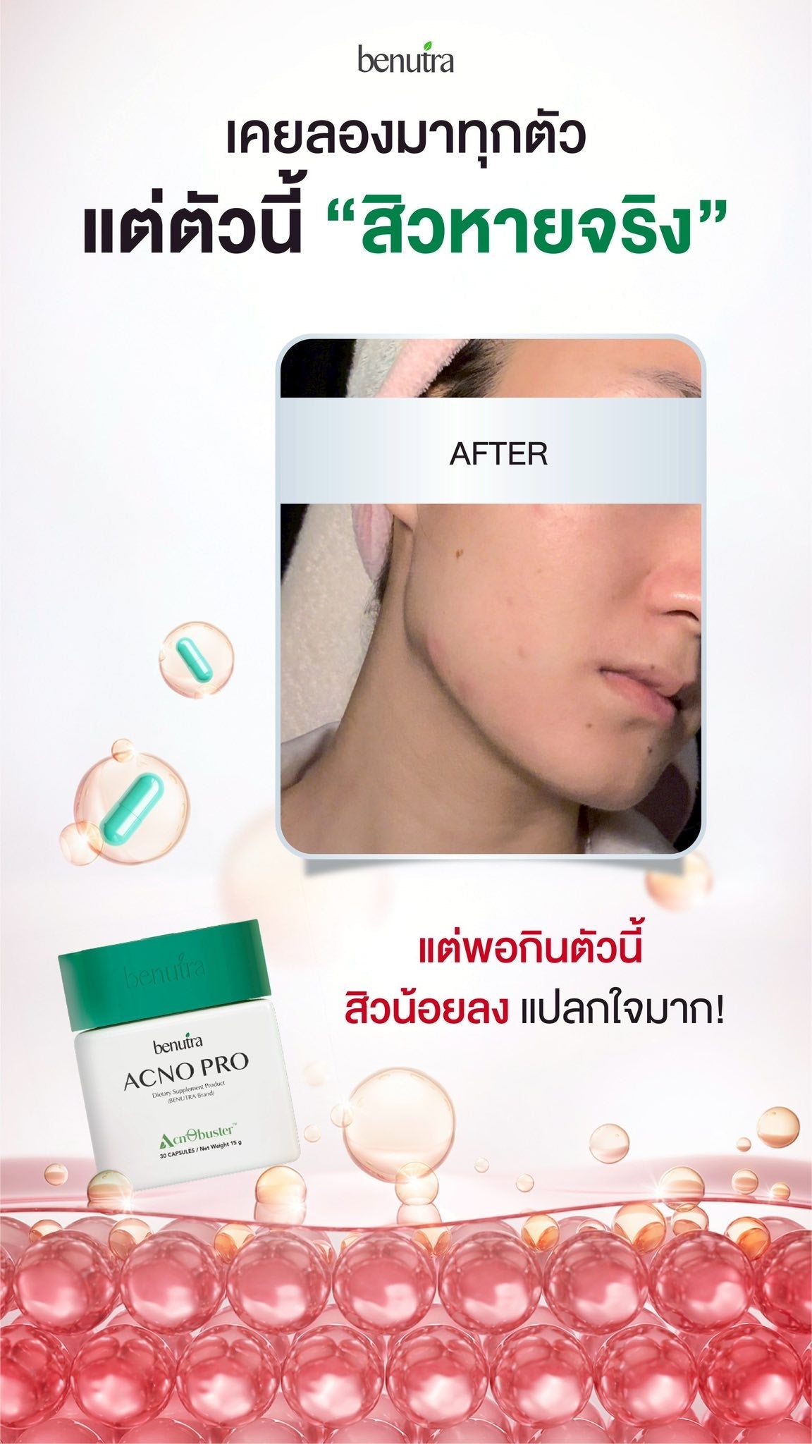 BENUTRA TETRA SOD with Astaxanthin CoQ10 Antioxidant Power for Skin Health