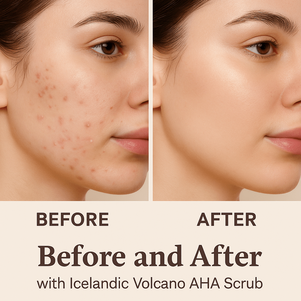 Icelandic Volcano AHA Face & Body Scrub