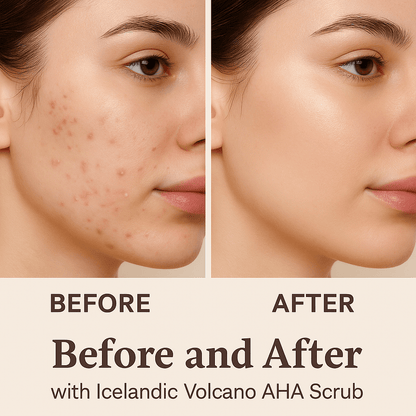 Icelandic Volcano AHA Face & Body Scrub
