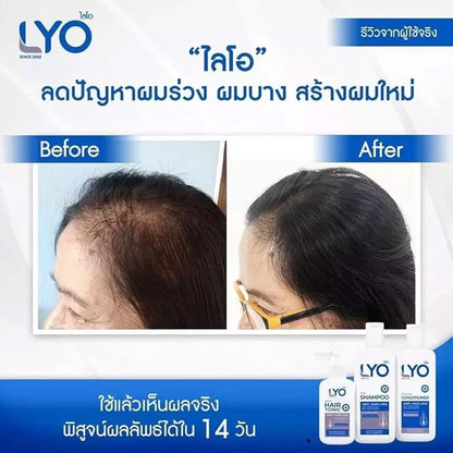 LYO Shampoo Conditioner Hair Tonic Treatment Hair Strengthen & Regrowth