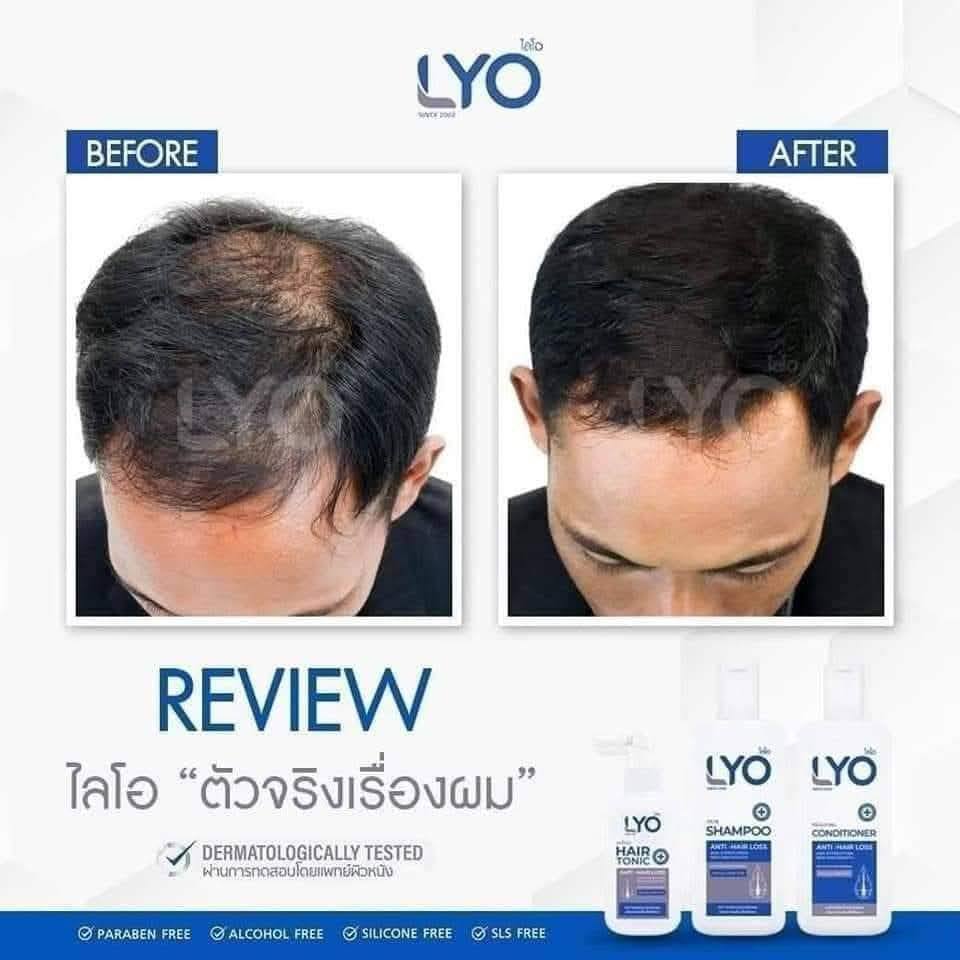 LYO Shampoo Conditioner Anti Hair Loss 200 ml