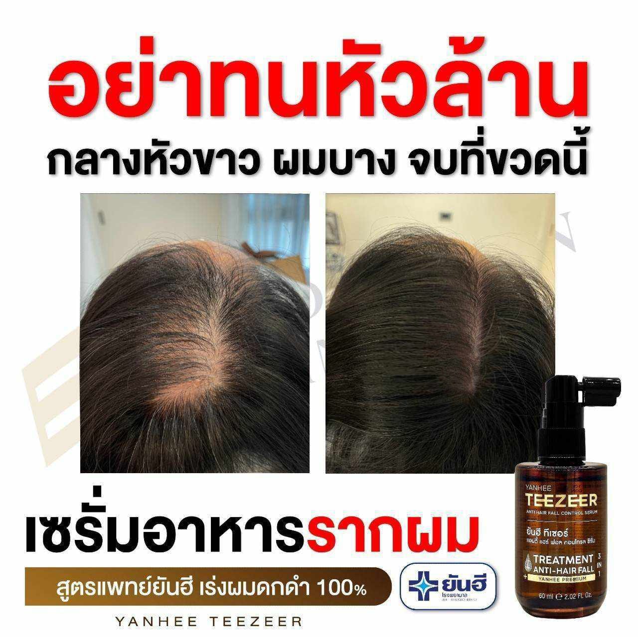 Yanhee Teezeer Shampoo 200 ml and Teezeer Serum Anti Hair Fall Control Serum 60 ml