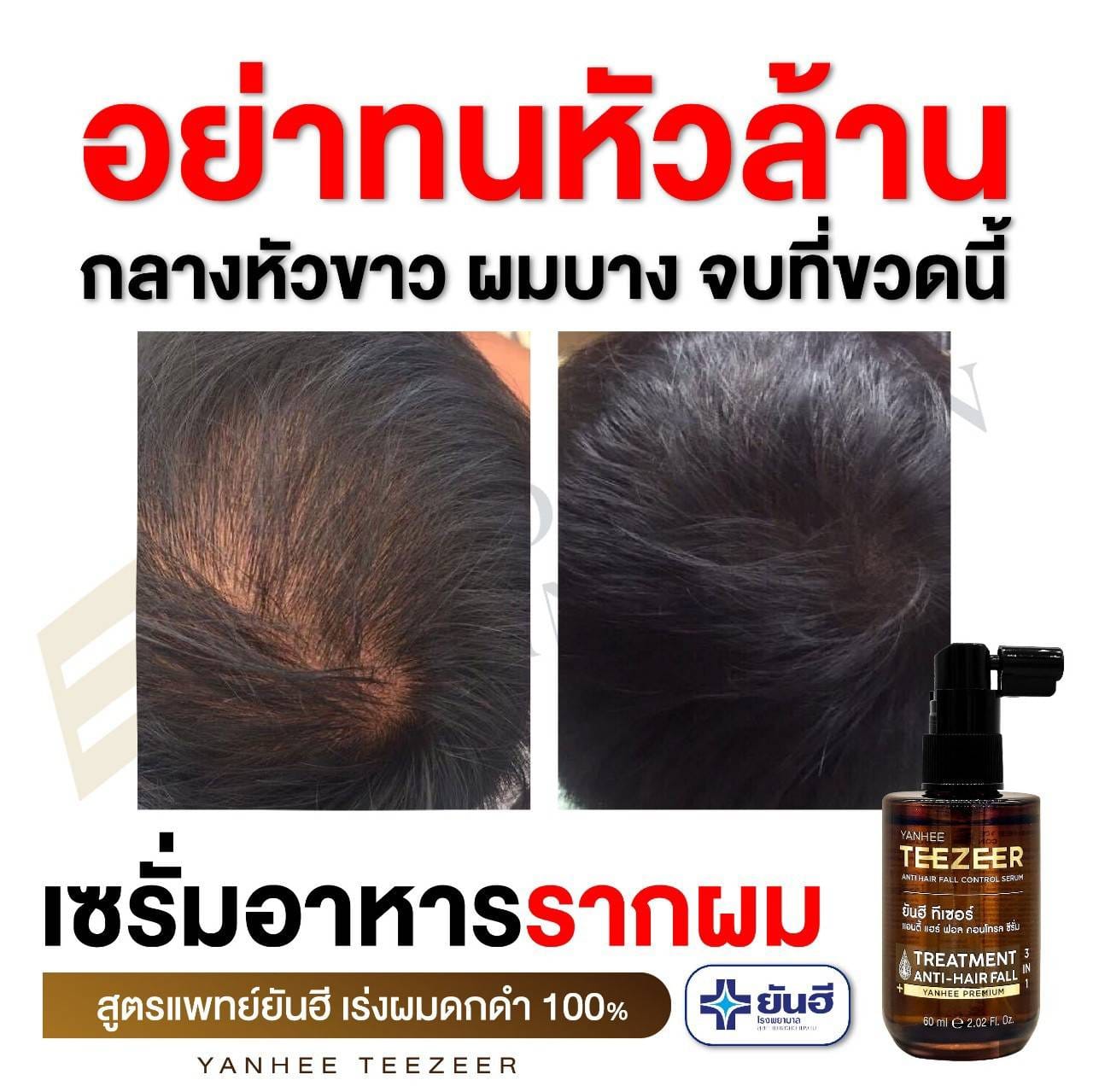Yanhee Teezeer Anti Hair Fall Nourishes Hair Roots Control Serum 60 ml